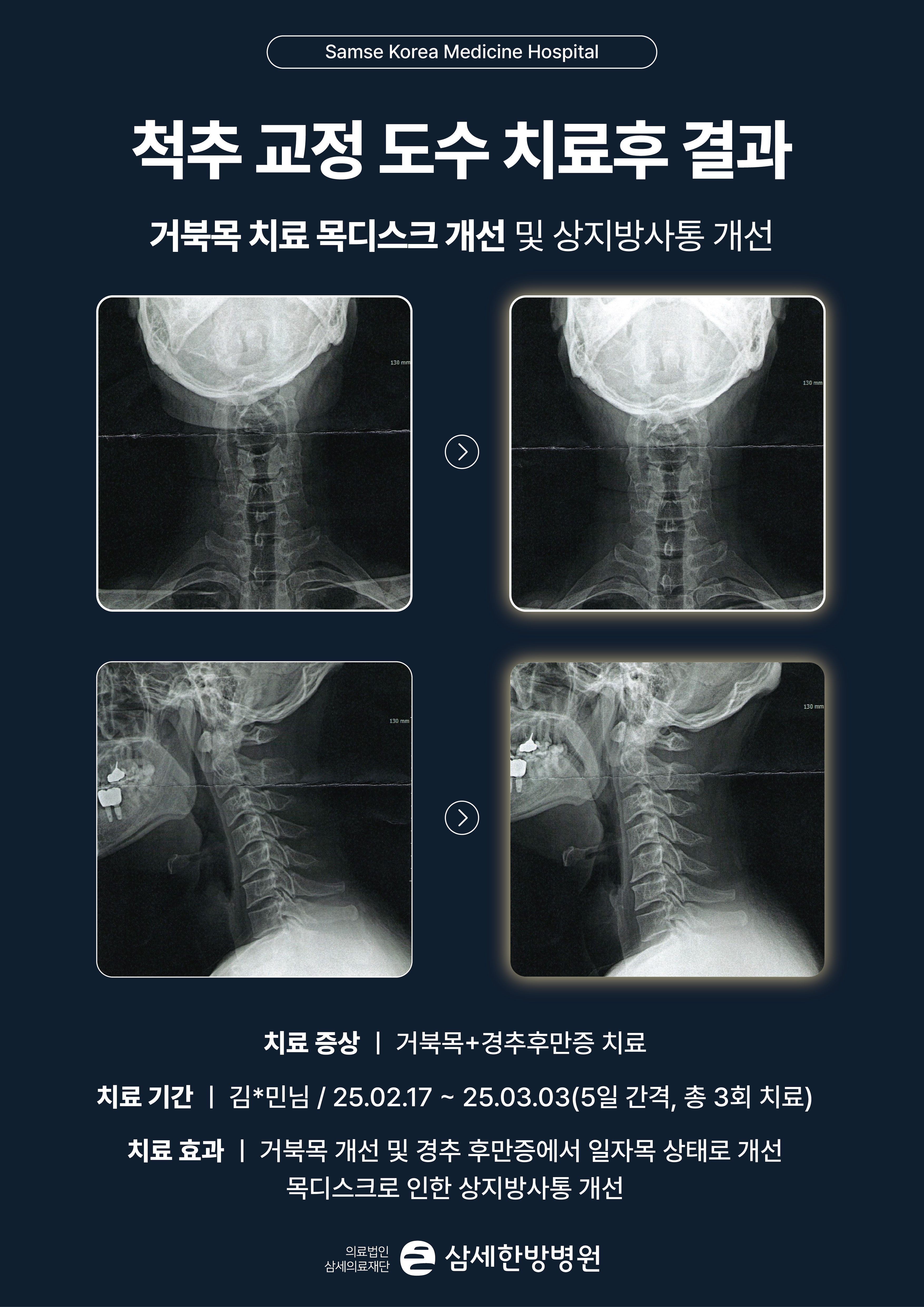비포애프터(1)